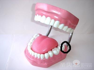 牙龈肿痛怎么治