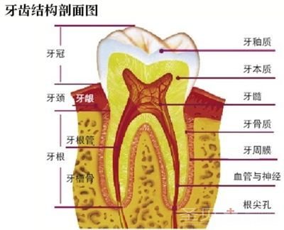 去除牙菌斑需要多少钱