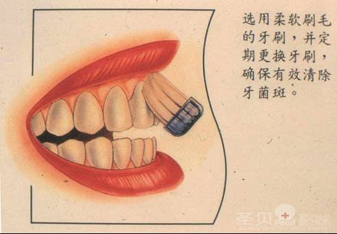 前牙黄黄的该怎么办