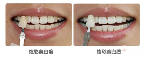 男人大黄牙怎么办