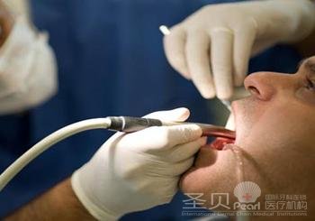 牙龈出血有哪些危害