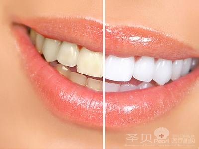 预防牙齿疾清洁是