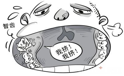 西安牙齿矫正需要拔智齿吗