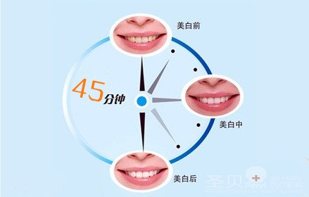 西安美容冠修复效果好不好