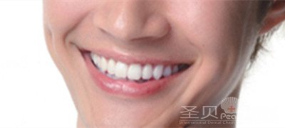 做美容冠我们应该注意哪些问题