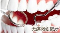 微痛拔牙真的微痛