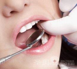 活动义齿的优缺点