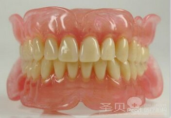活动义齿的优缺点