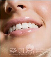 怎么去除烟渍牙