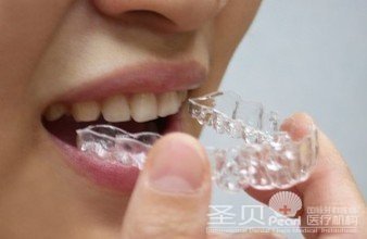 牙齿稀疏要怎么治疗