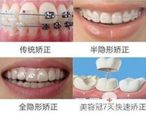 西安矫正牙齿哪家医院好
