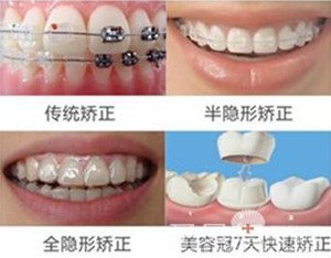 西安牙齿矫正哪家医院好