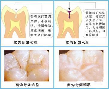 说明: https://timgsa.baidu.com/timg?image&quality=80&size=b9999_10000&sec=1490606209854&di=8c56ed4785106d6e14ea70c01c710e05&imgtype=0& data-cke-saved-src=http%3A%2F%2Fwww.zstorch.gov.cn%2Fmyfiles%2Fadmin%2F111_20160923094300s6.jpg src=http%3A%2F%2Fwww.zstorch.gov.cn%2Fmyfiles%2Fadmin%2F111_20160923094300s6.jpg