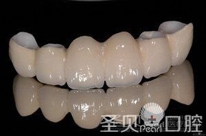 成都做全瓷牙哪家医院好